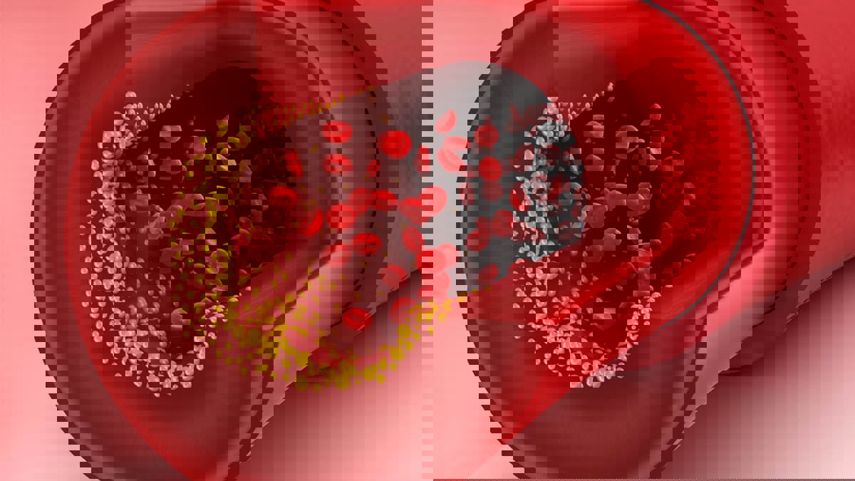 البثور على الجفون والأنف قد تكون علامة على ارتفاع الكولسترول