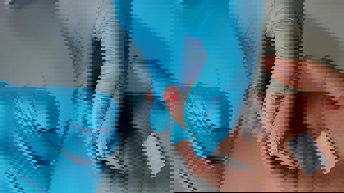 ثلث مرضى نقص المناعة البشرية يتم تشخيصهم في مرحلة متقدمة في فرنسا