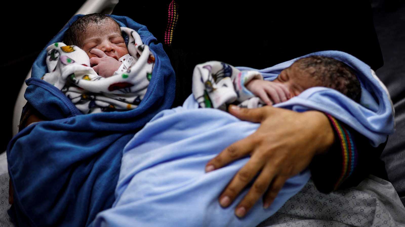 سيمتد لأجيال.. الأمم المتحدة تحذر من تأثير سوء التغذية في غزة