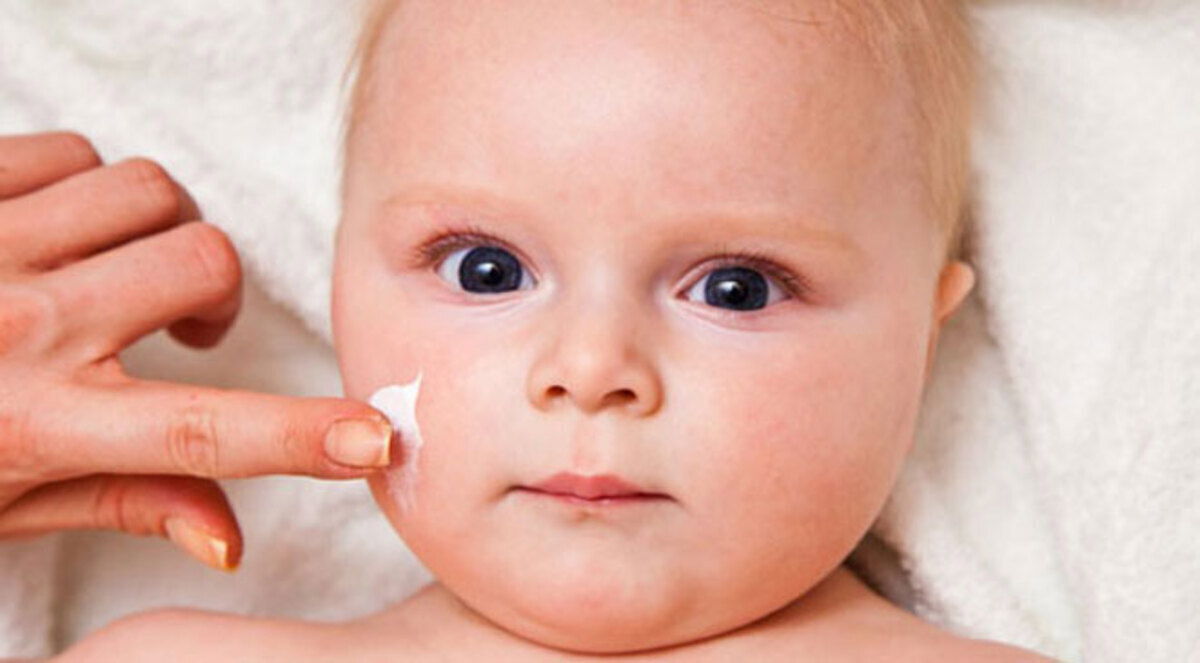 الترطيب يمنع تهيج بشرة طفلك المصاب بالتهاب الجلد