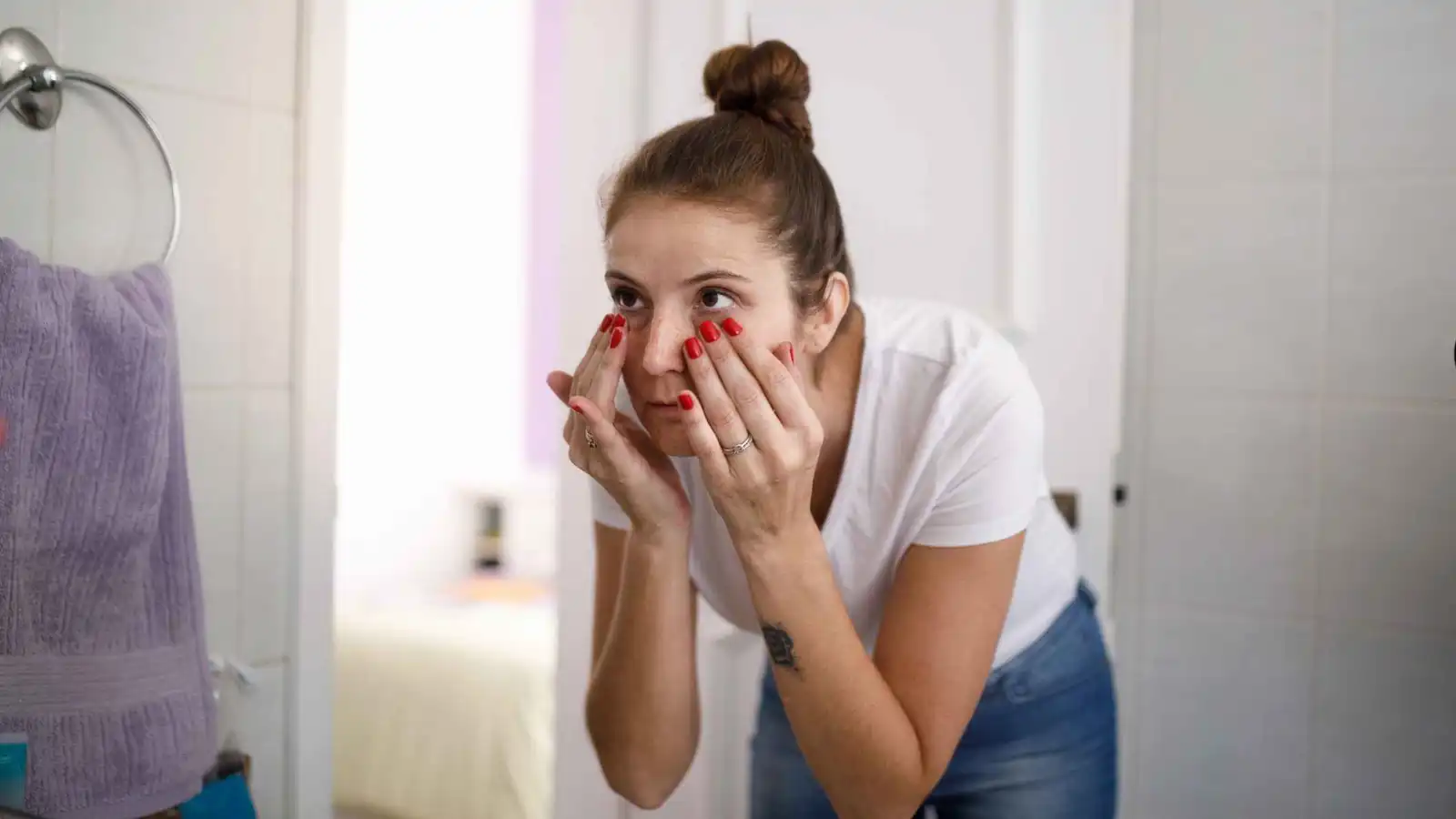 من التصبغ إلى ترهل الجلد.. أسباب الهالات السوداء