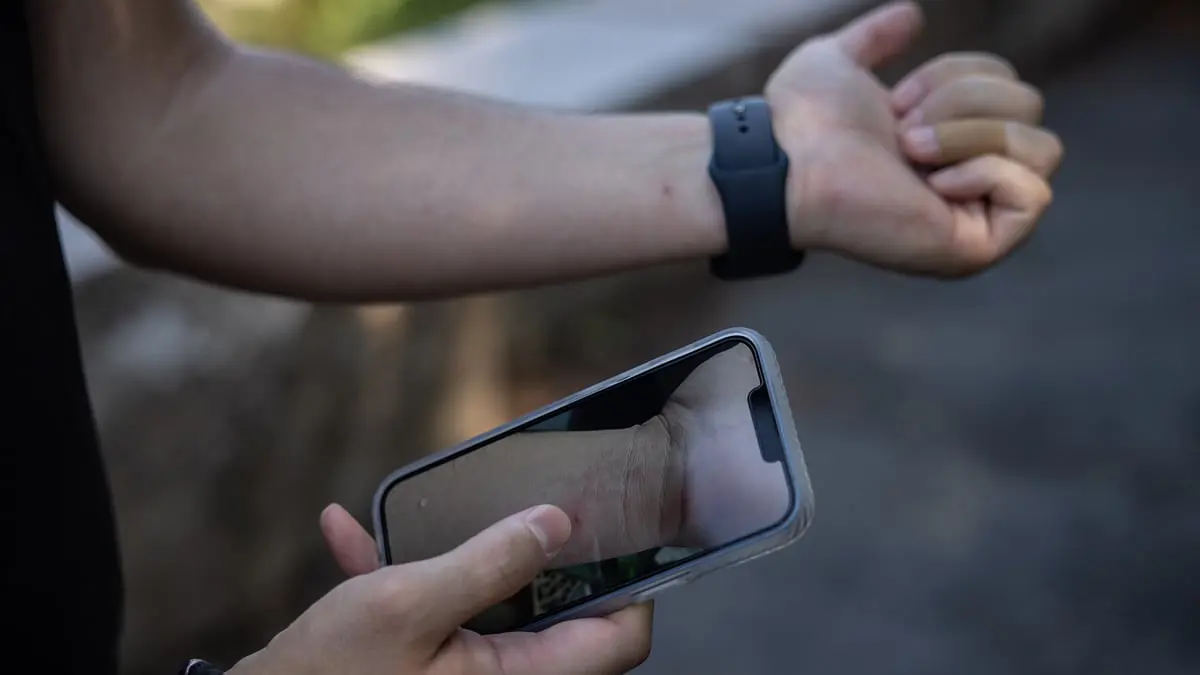 الصحة العالمية بصدد اتخاذ قرار مرتقب بشأن جدري القرود