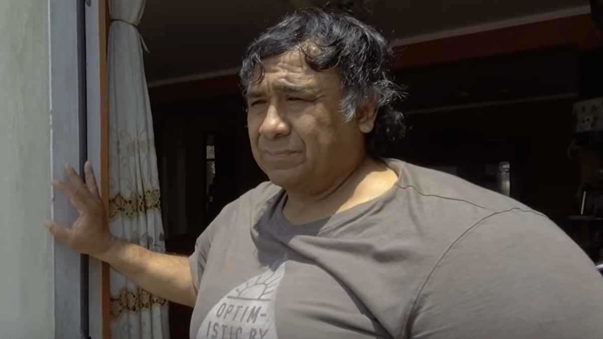 غواص يعيش 8 سنوات مع تشوهات نادرة بعد حادث مروع (صور)