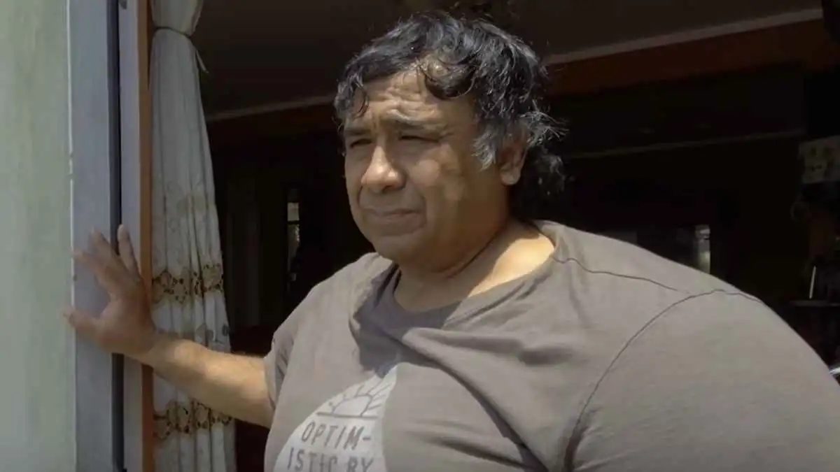 غواص يعيش 8 سنوات مع تشوهات نادرة بعد حادث مروع (صور)