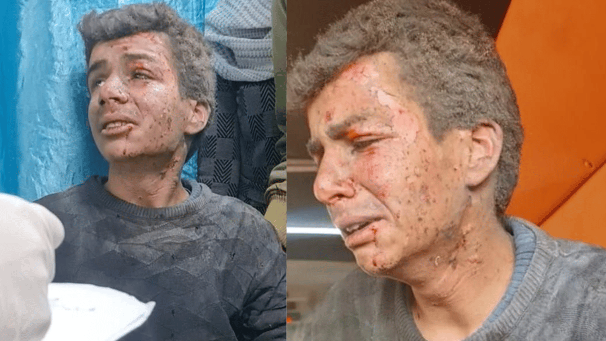 غزة.. الفتى "صيام" يروي تفاصيل مقتل جميع أفراد عائلته حرقاً