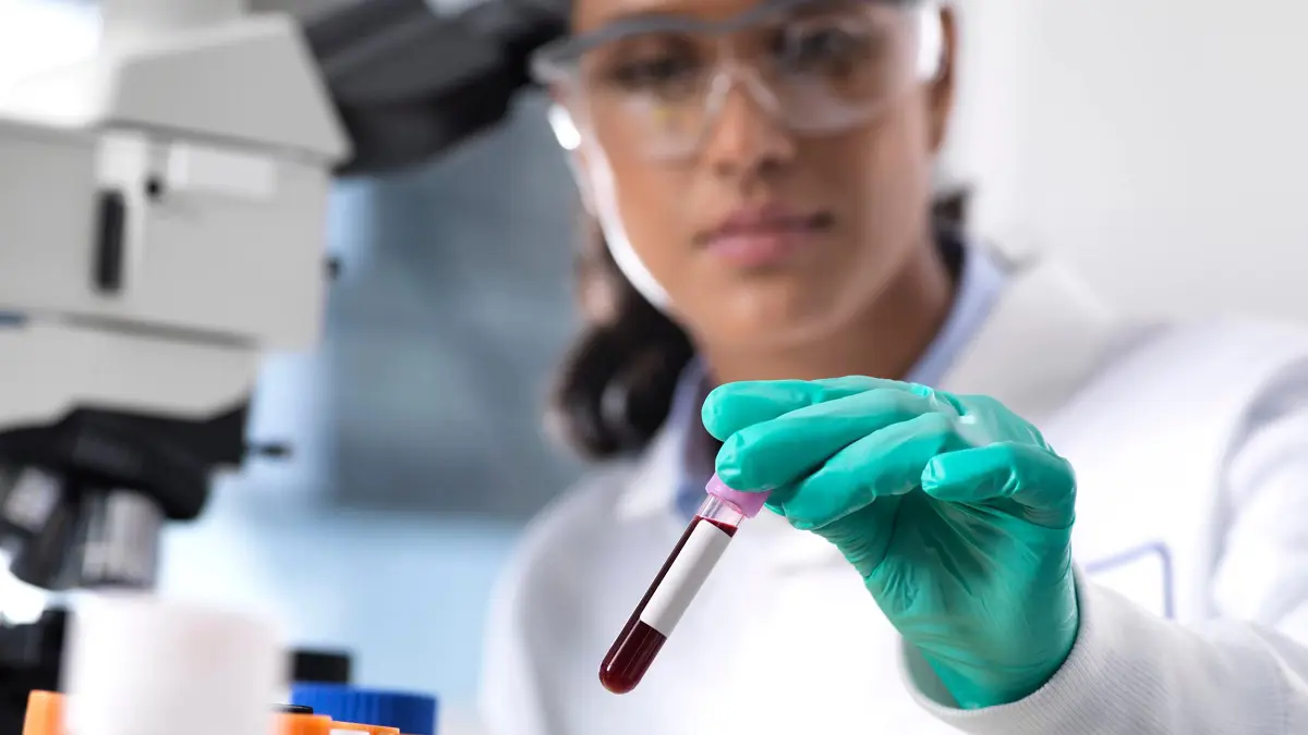 اختبار دم جديد بالذكاء الاصطناعي للكشف عن سرطان الكبد