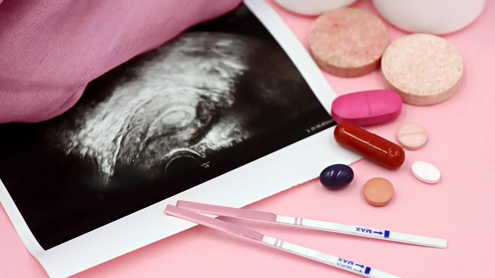 حادثة "صادمة".. امرأة تقاضي عيادة إخصاب بعد زرع الجنين الخطأ