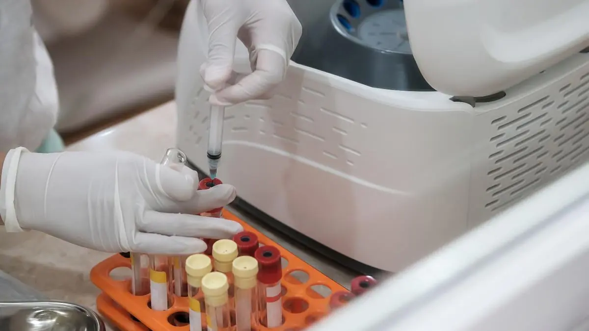 علاجات واعدة لالتهاب المفاصل التنكسي