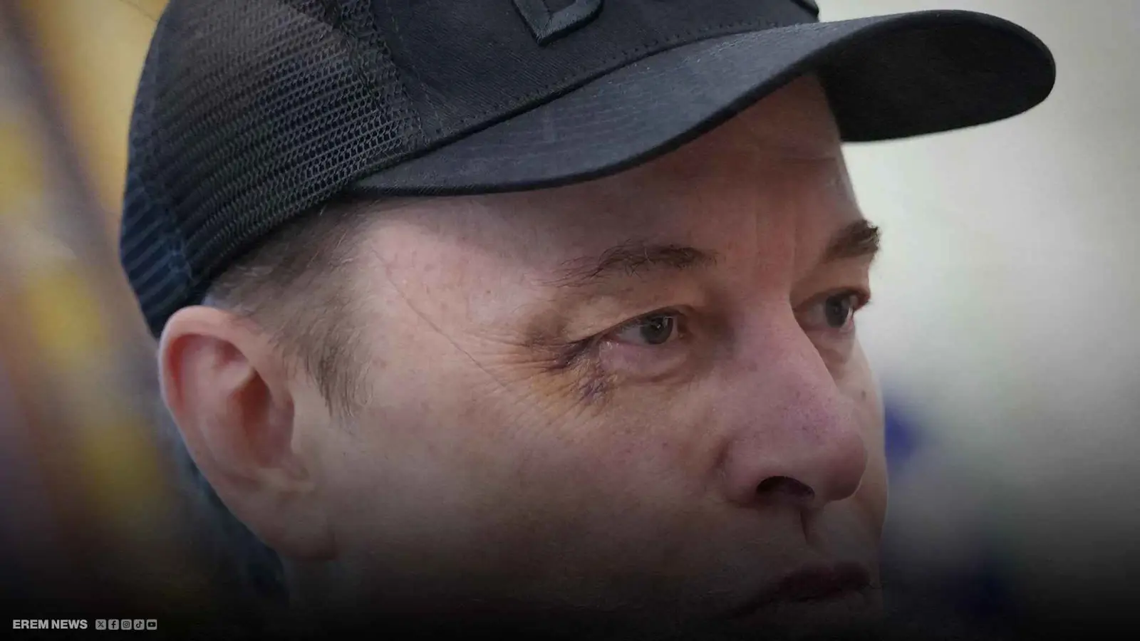 كدمة على عين ماسك