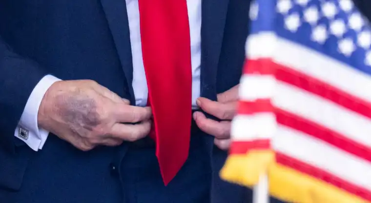 كدمة الرئيس الأمريكي 