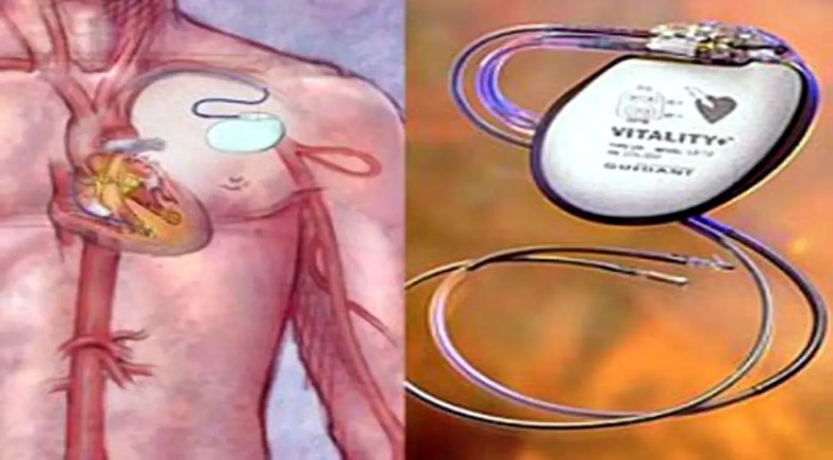 سويسري يبتكر جهازا ذاتي الحركة لتنظيم ضربات القلب