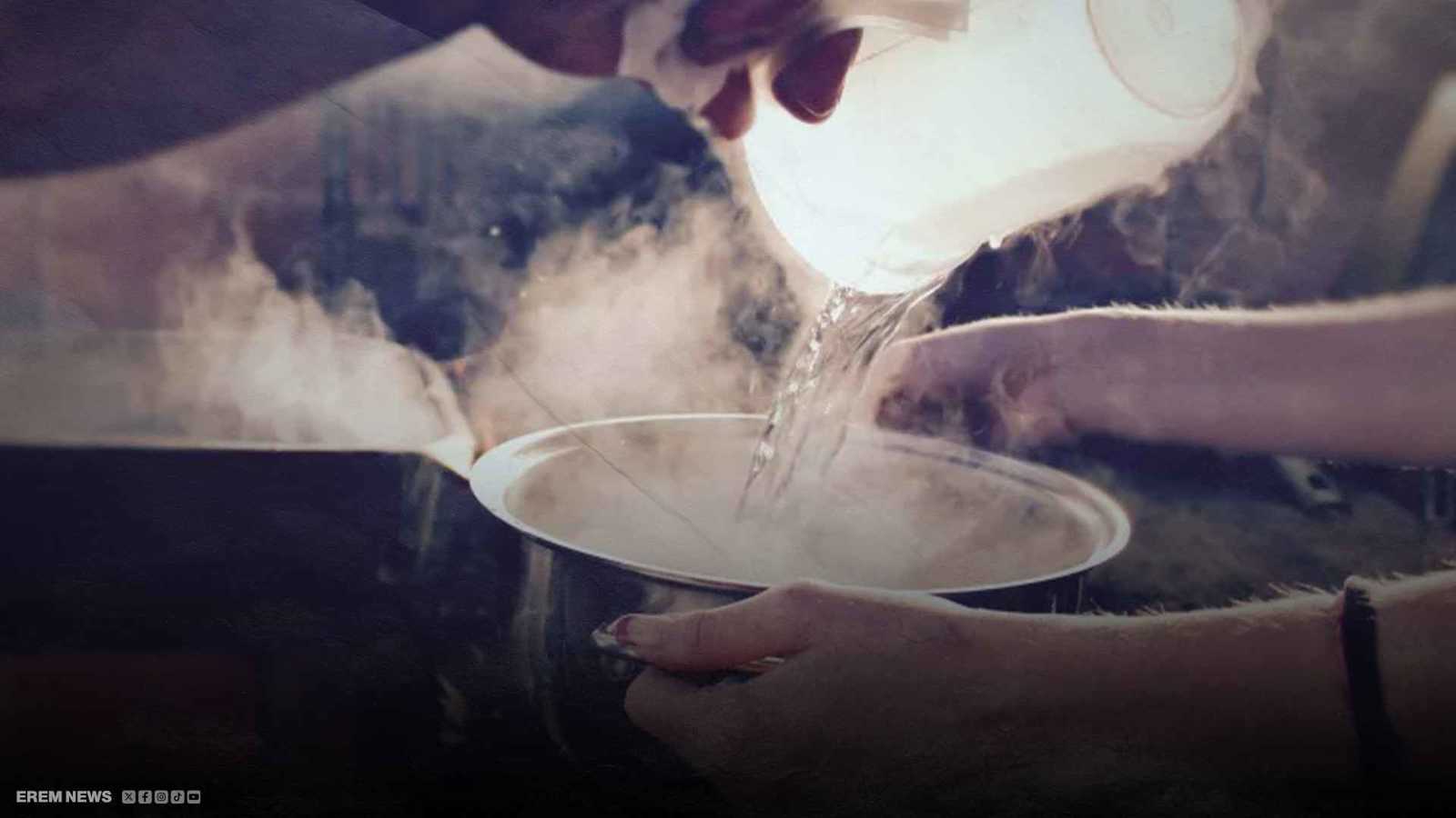 "تحدي الماء الساخن" على تيك توك يصيب طفلاً بحروق خطيرة (فيديو)