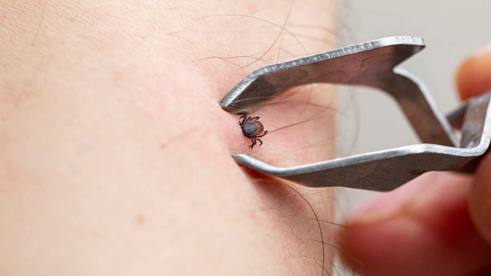 كيف أسهمت الأنشطة البشرية في زيادة خطر أمراض القراد؟