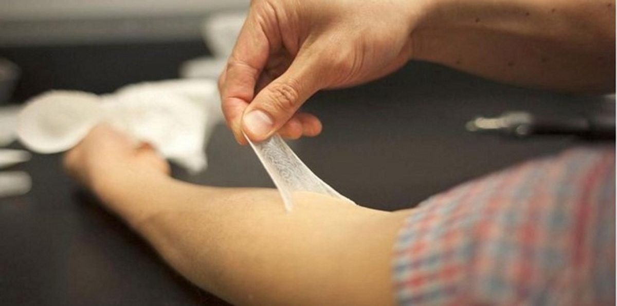 ابتكار بشرة جلد "مستعار" للتخلص من الشيخوخة