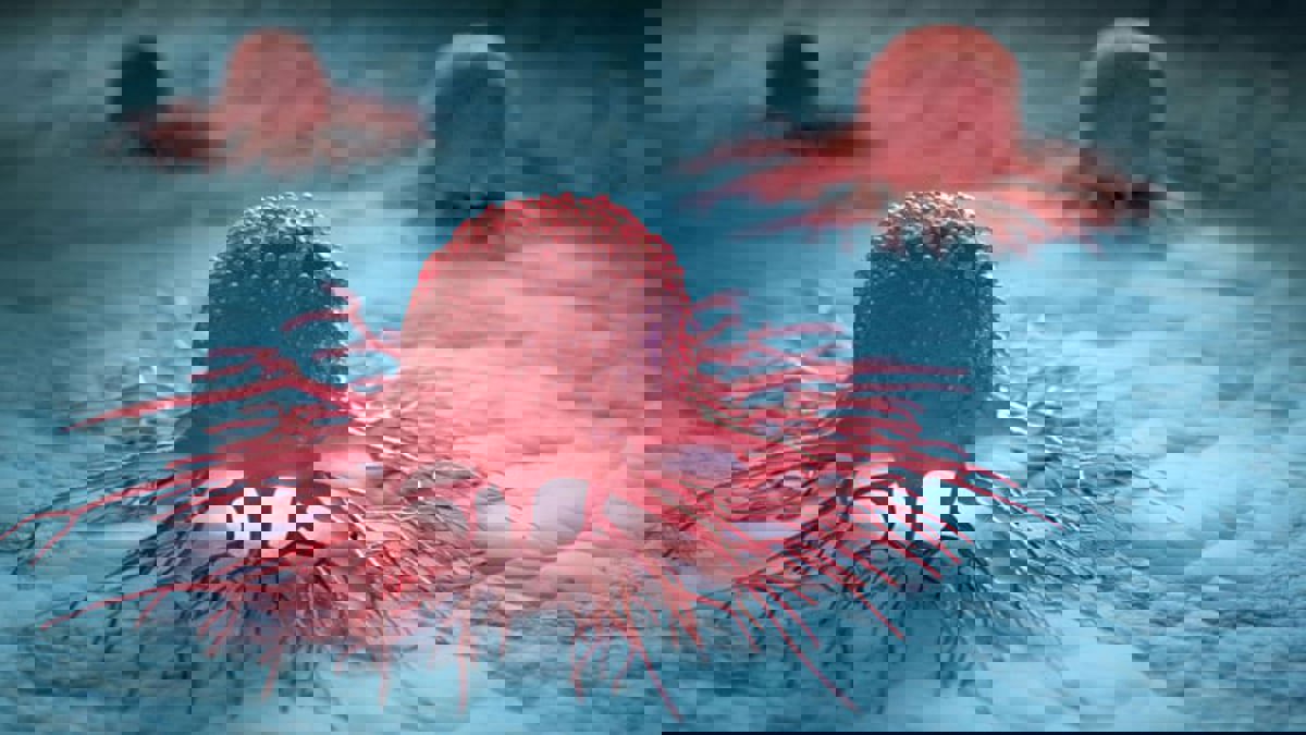 عادات غذائية خاطئة تحفز الإصابة بالسرطان 