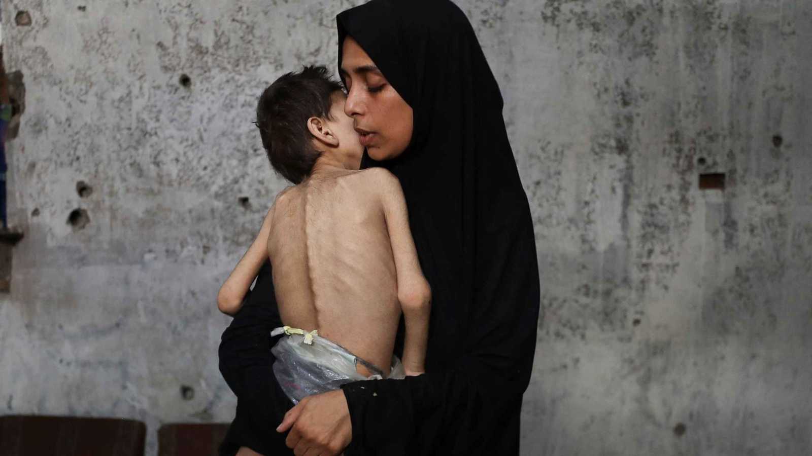 غزة.. مأساة الجوع تحصد أرواح 159 شخصاً