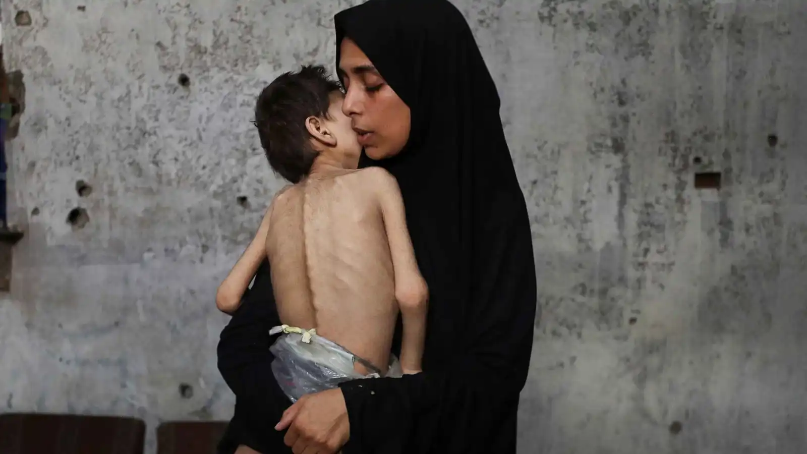 غزة.. مأساة الجوع تحصد أرواح 159 شخصاً