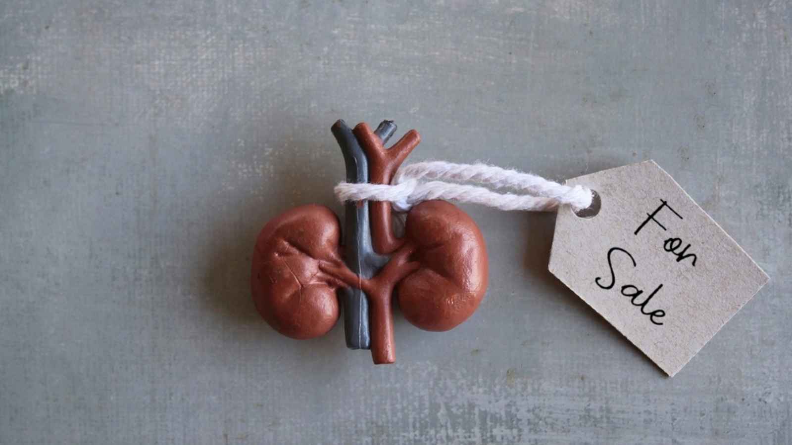 أقنعت زوجها ببيع كليته وسرقت المال للهروب مع عشيقها