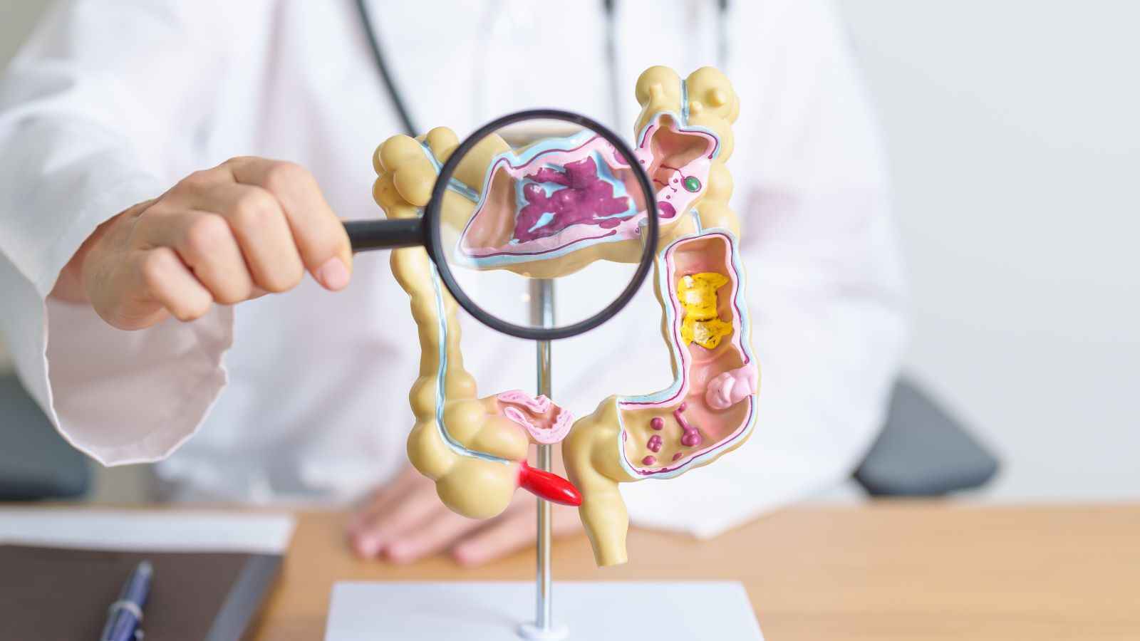 اختبار "ذكي" للكشف المبكر عن سرطان القولون