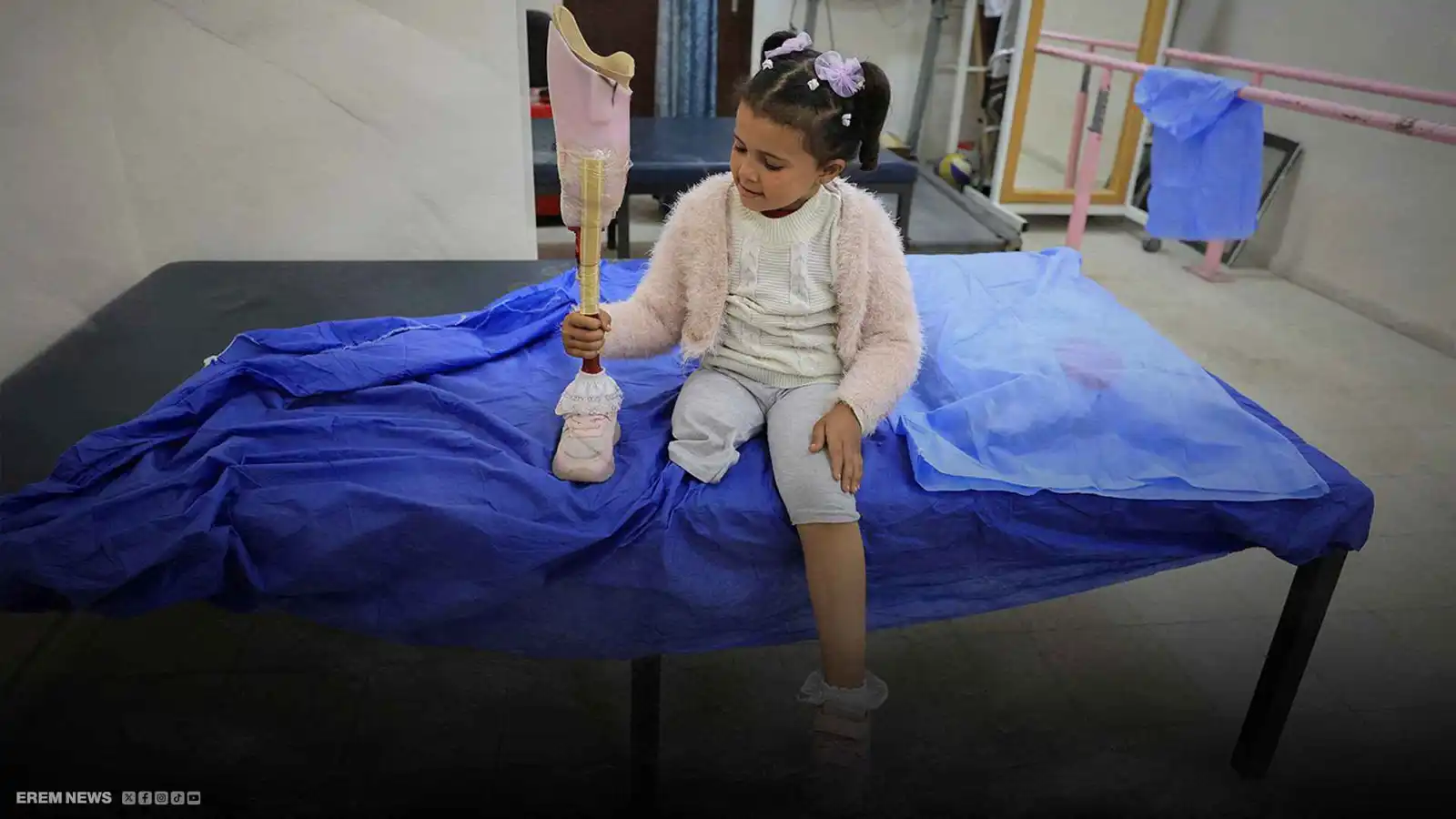 آلاف الأقدام المبتورة.. أطراف من حديد تمشي فوق الذاكرة بغزة