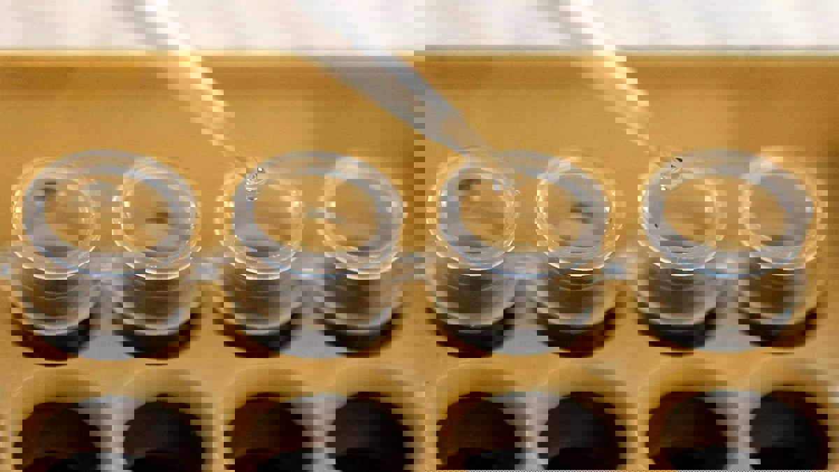 تقنية حديثة لتشخيص سرطان البنكرياس في مراحله الأولى