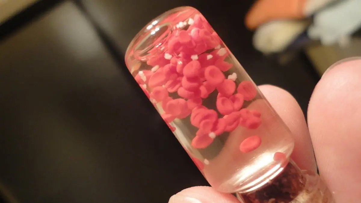 أطعمة تساهم في زيادة مذهلة لنسبة الصفائح الدموية.. تعرف عليها