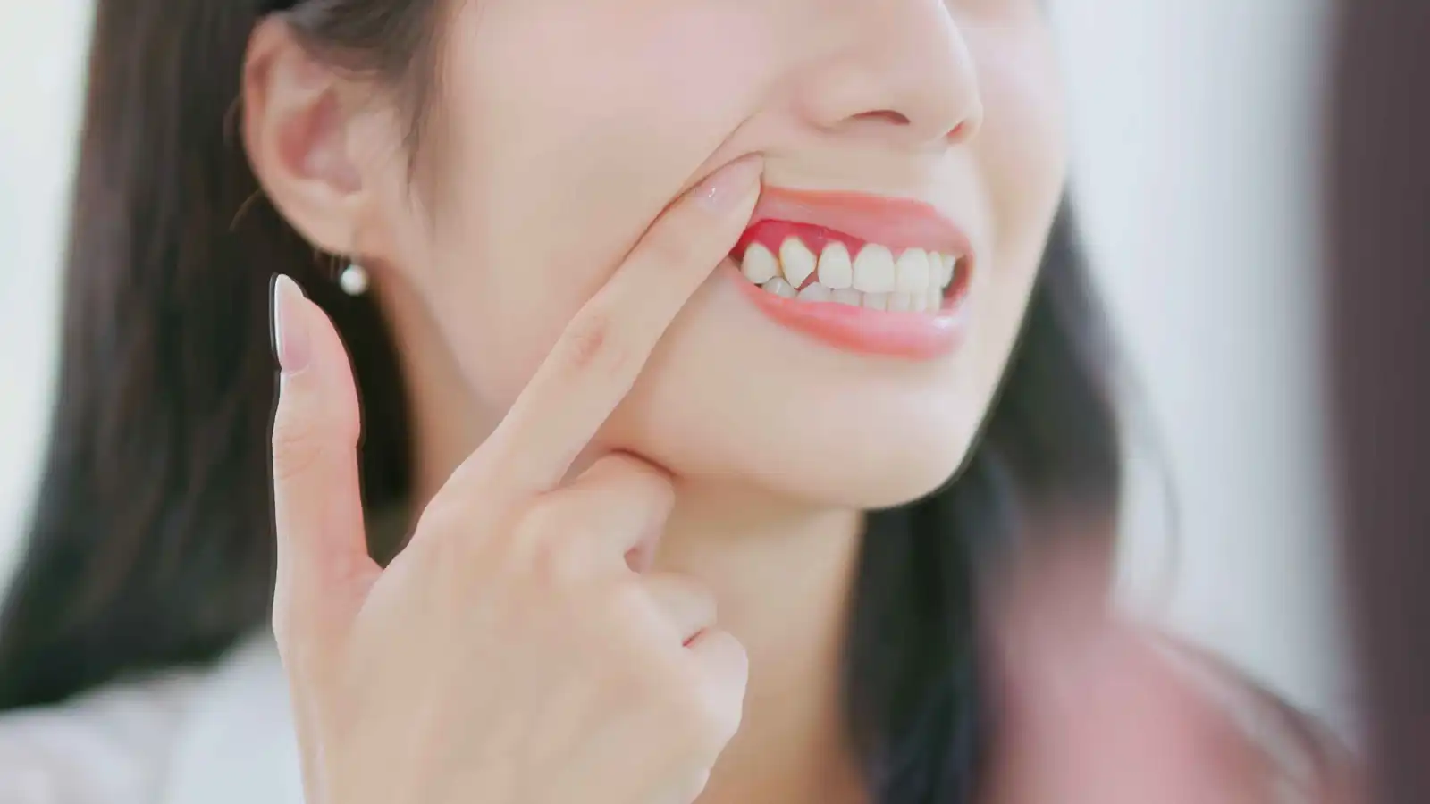 أمراض اللثة تزيد خطر تلف المادة البيضاء في الدماغ