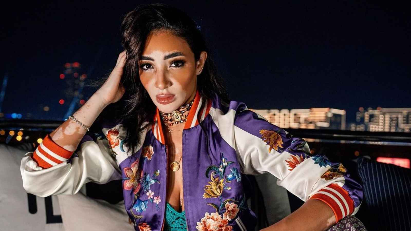 تنافس ملكات الجمال.. من هي لوجينا صلاح متحدية البهاق والتنمر؟ (صور)