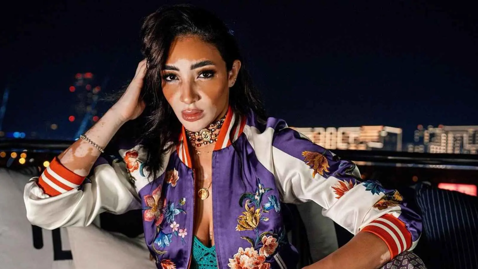 تنافس ملكات الجمال.. من هي لوجينا صلاح متحدية البهاق والتنمر؟ (صور)