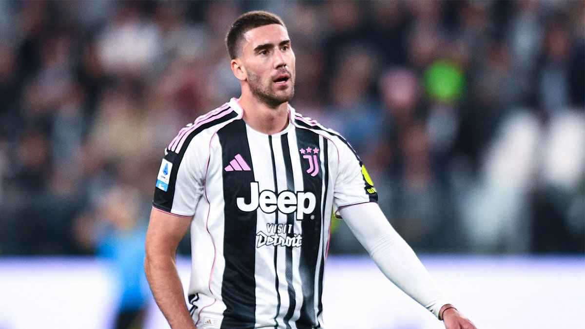 على طريقة كريستيانو رونالدو.. عضلات ساقي نجم يوفنتوس تلفت الأنظار (صور)