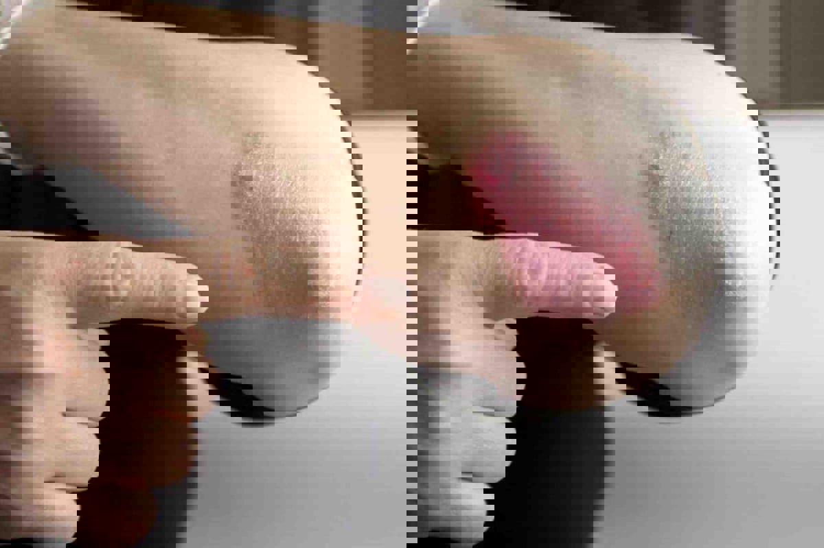 10 طرق طبيعية للتخلص من الصدفية