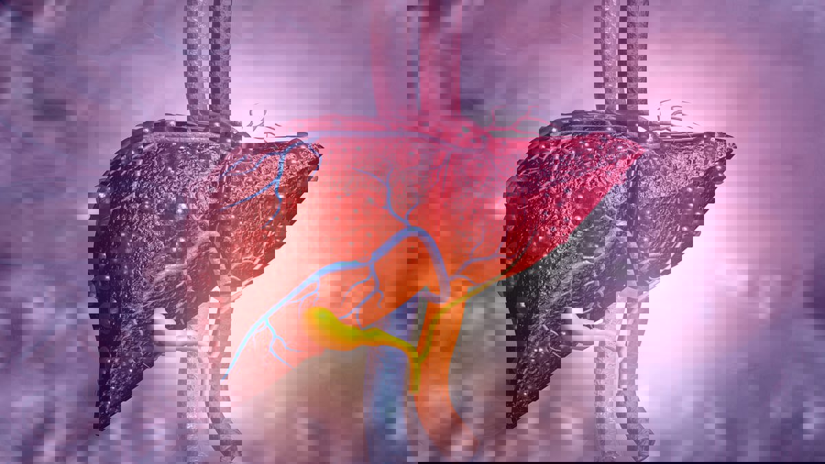 7 علاجات منزلية لمرض الكبد الدهني