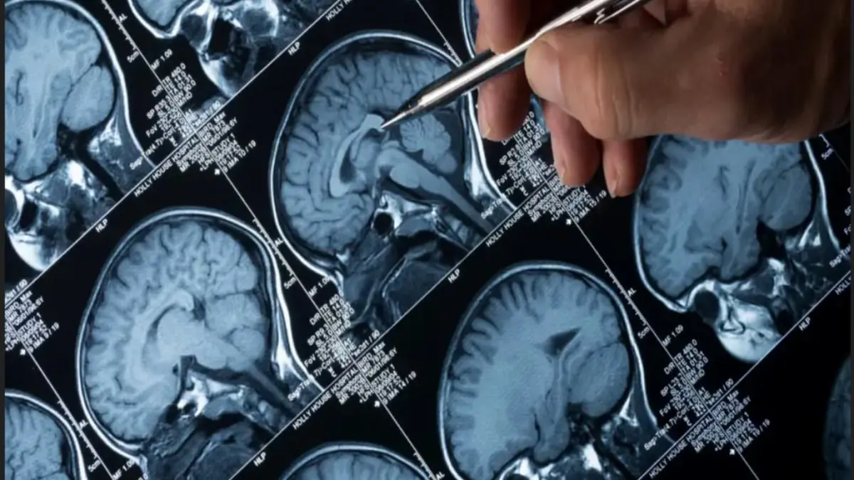 علماء: التشخيص المبكر لأورام الرأس والرقبة يسهم في علاجها بنسبة 80%