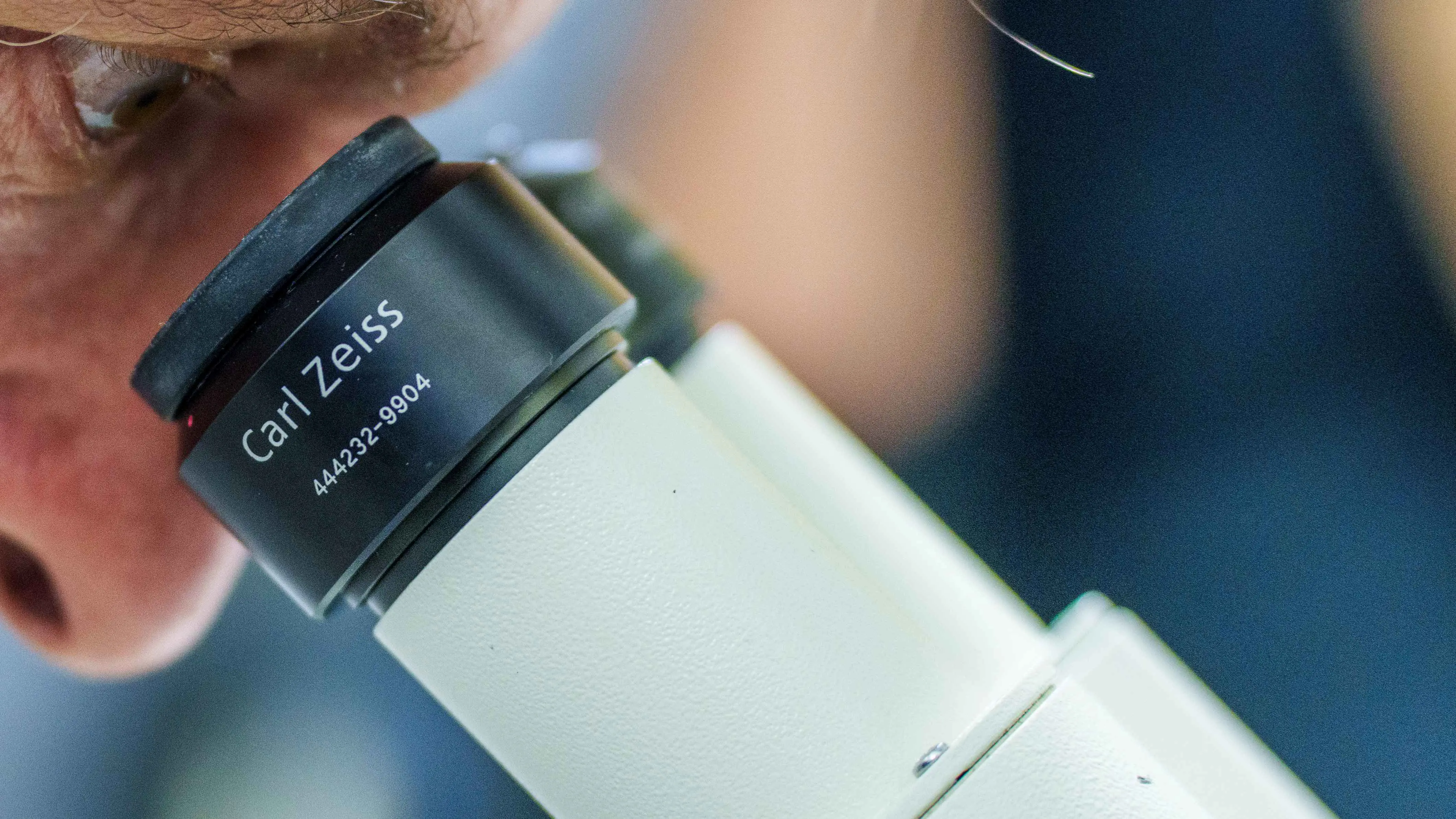 "قنبلة السكر".. ابتكار سوري يمهّد لثورة في علاج السرطان