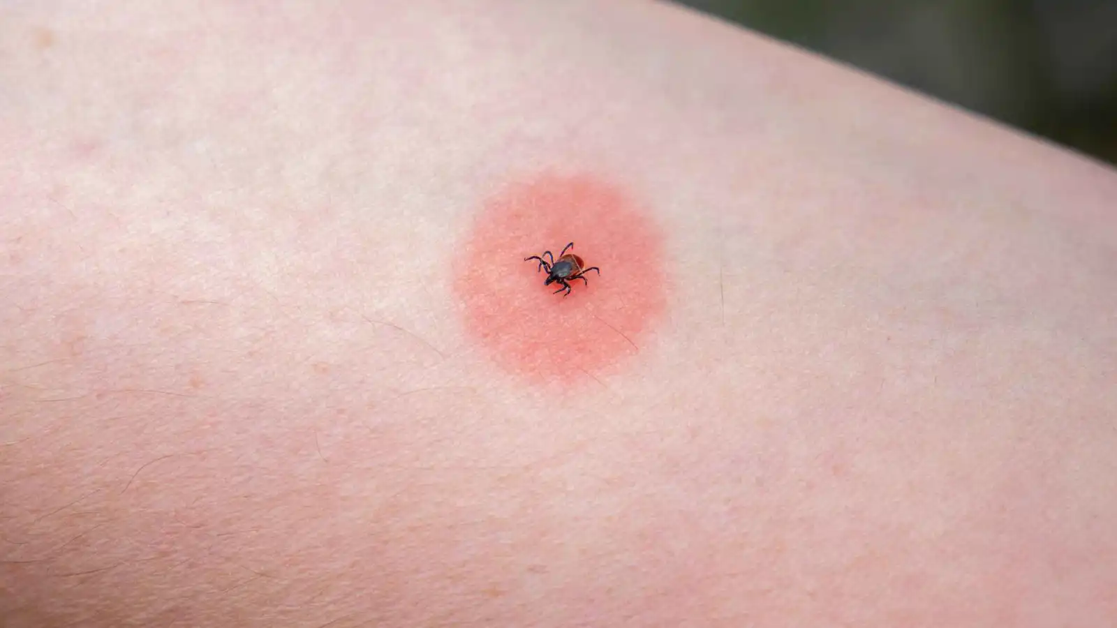 مع دخول الربيع.. 5 نصائح ذهبية لحماية نفسك من القراد أثناء التنزه