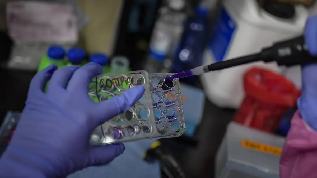 تطوير خلايا عصبية بديلة لمرضى باركنسون