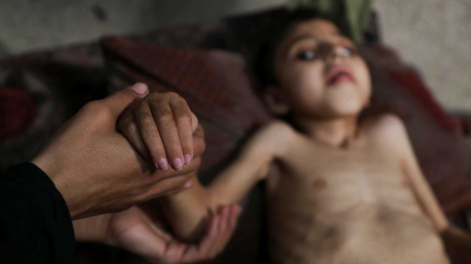 "هآرتس" تهاجم "نيويورك تايمز" بسبب صورة طفل من غزة.. فما القصة؟