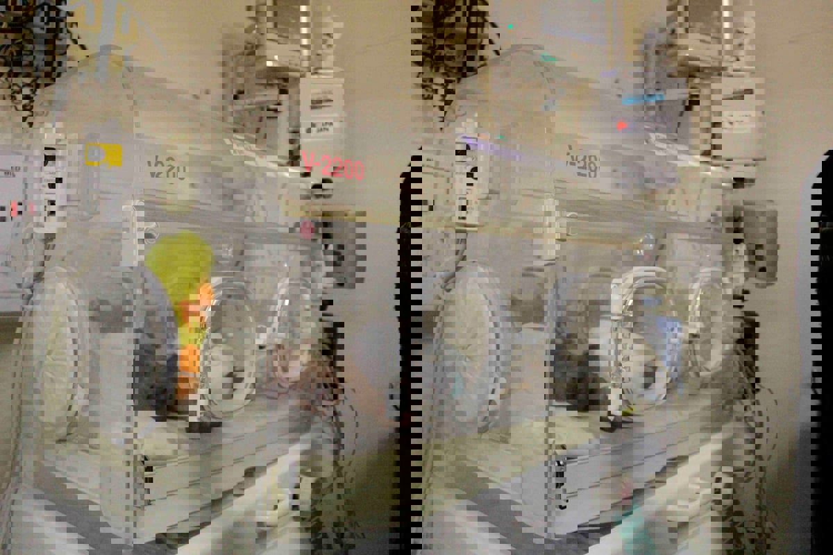 حالة نادرة.. "توأم عنكبوتي" من إندونيسيا يجلسان لأول مرة