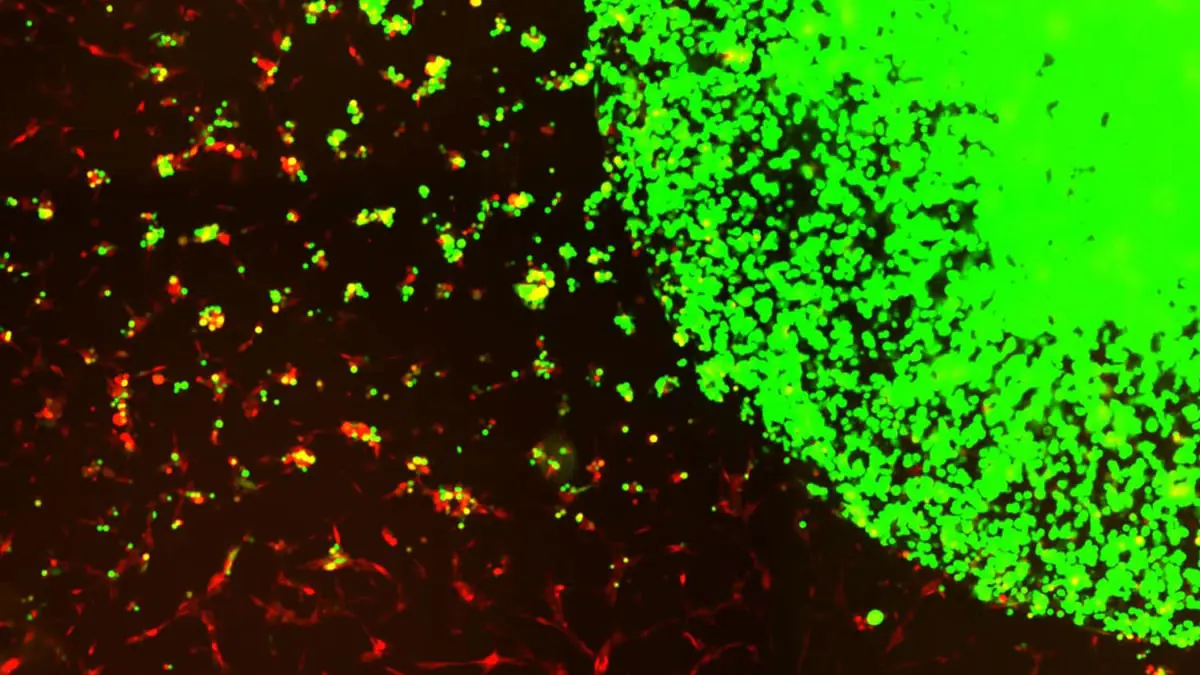 تطوير خلايا جذعية "هندسياً" لعلاج أخطر أنواع الأورام