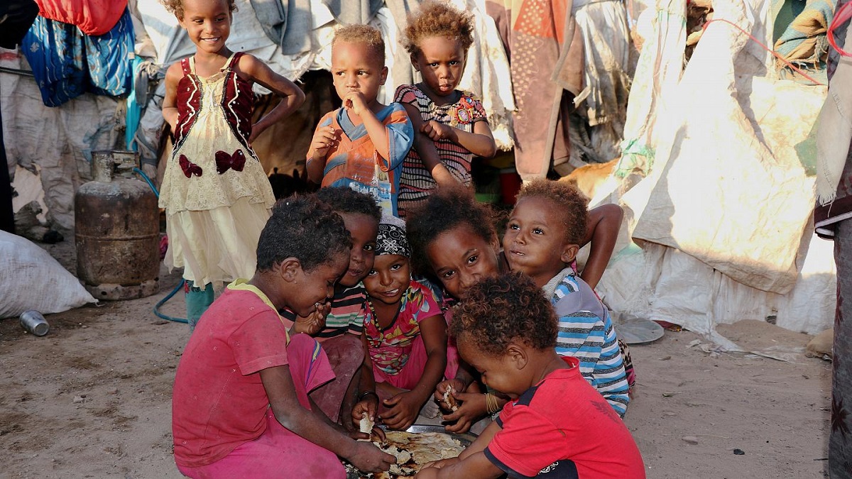 حكاية طفل يمني يعاني من سوء التغذية في مشفى بصنعاء