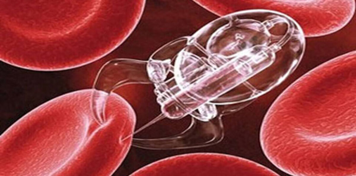 ابتكار "قذائف دوائية" تدمّر الخلايا السرطانية في بريطانيا