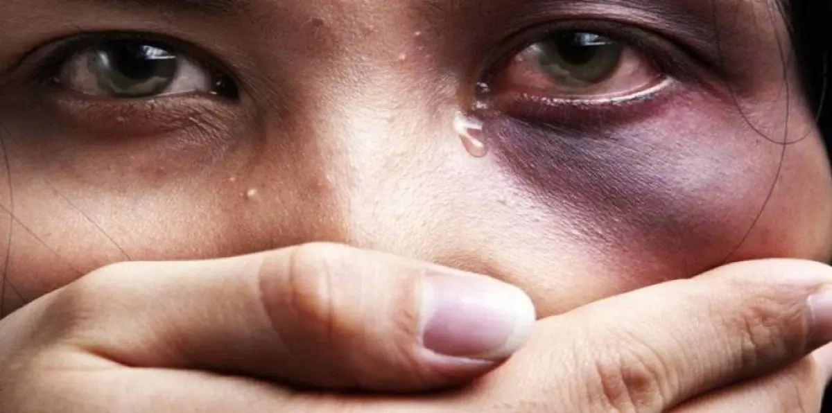 مدمن يشوه زوجته ويبتزها بسبب المخدرات