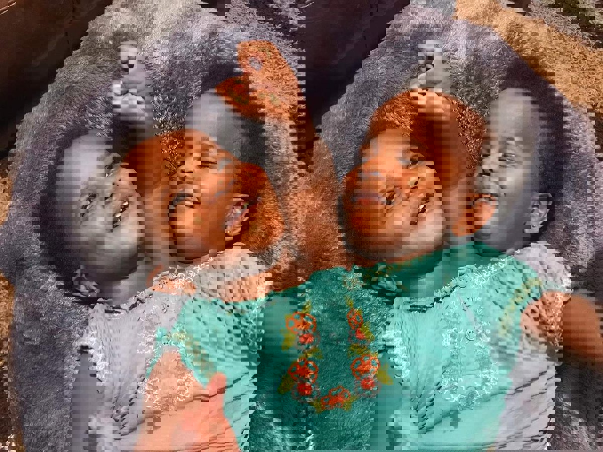 مريم وندى.. ما قصة التوأم الملتصق الوحيد على قيد الحياة في أوروبا؟ (صور)