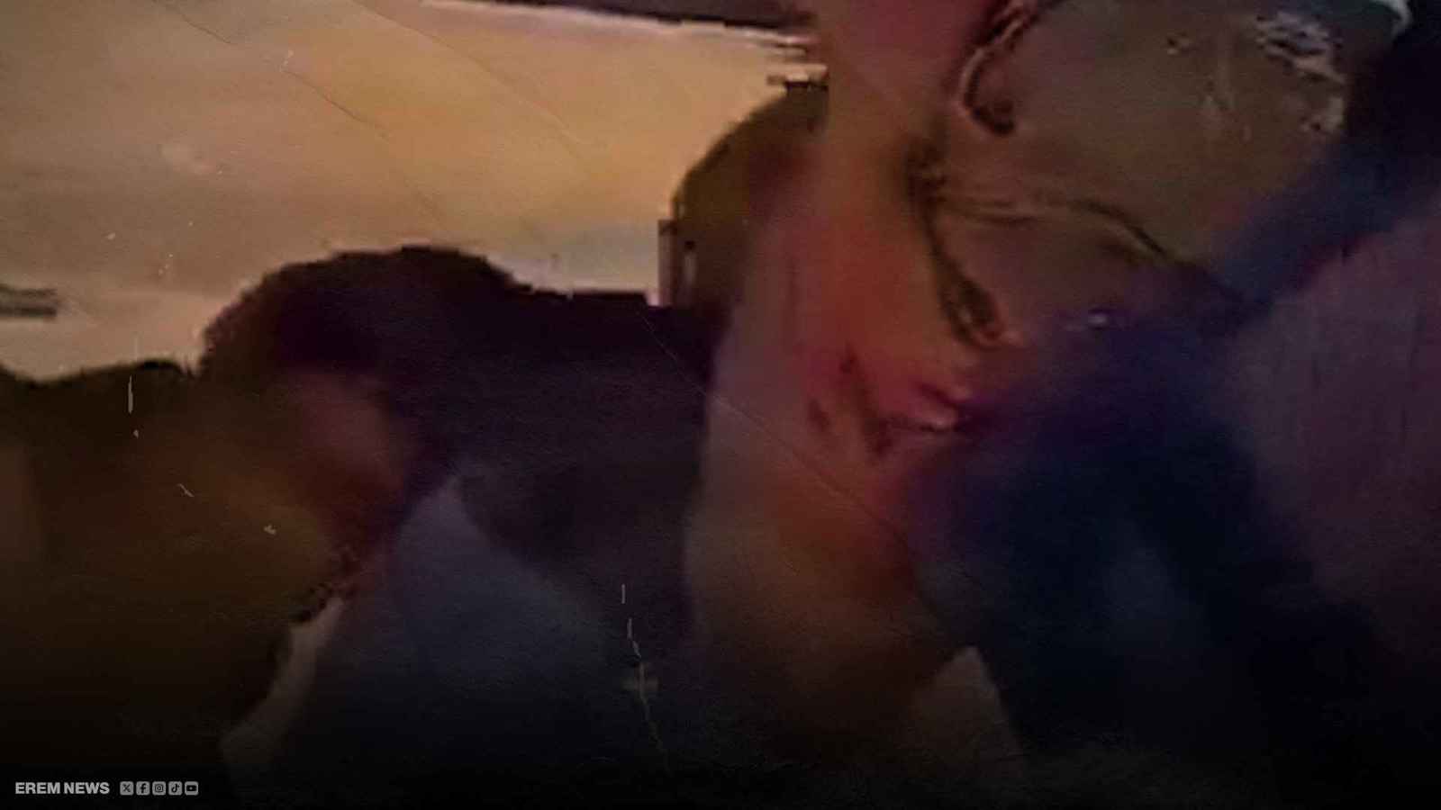 مشهد يهزّ الجزائر..شاب يهاجم مراهقاً من ذوي الاحتياجات بكلب شرس (فيديو إرم)