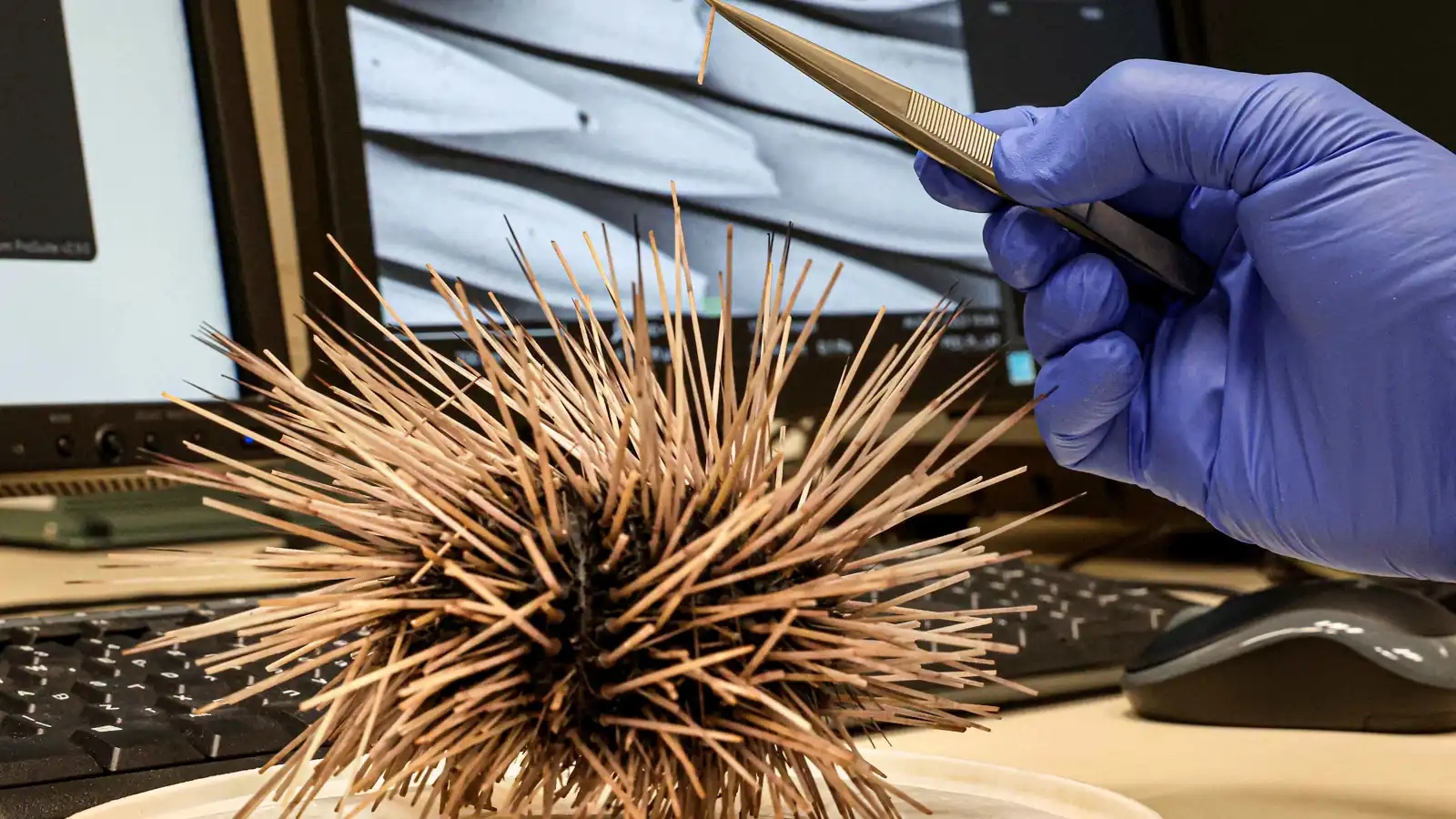 معهد روسي يرصد مركّبات بحرية ذات نشاط مضاد للخلايا السرطانية