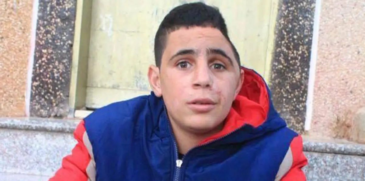 رغم إصابة أفقدته جزءًا من جمجمته.. الطفل محمد التميمي تحت وطأة قيود الاحتلال الإسرائيلي (صور)