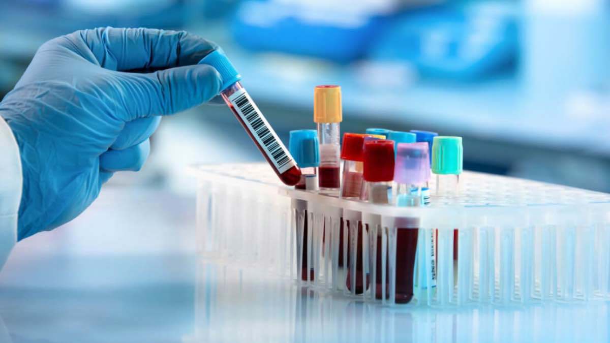 هذا الجهاز "الرخيص" يكشف السرطان بقطرة دم