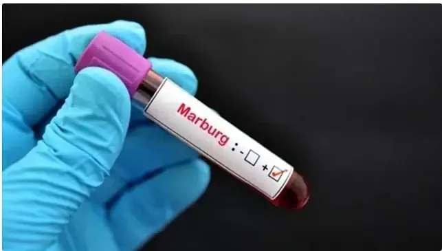 الصحة الإماراتية توصي بتأجيل السفر إلى تنزانيا وغينيا الاستوائية بسبب فيروس ماربورغ