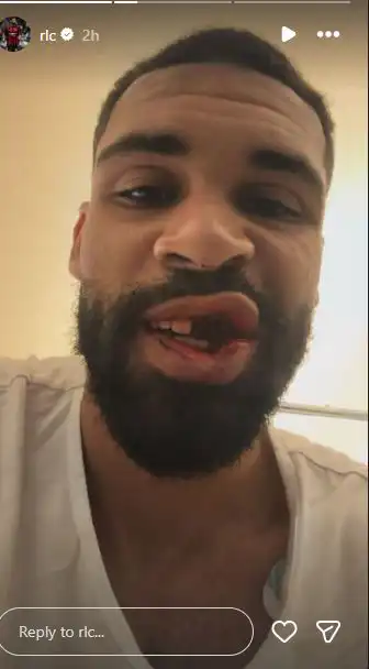 روبن لوفتوس-تشيك