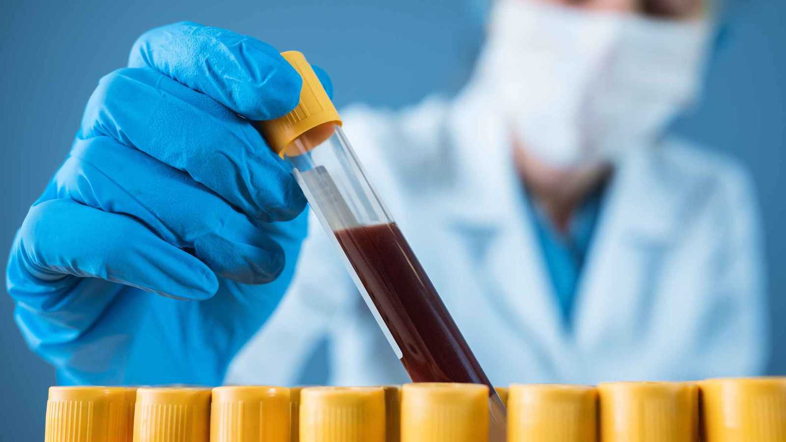 شريحة روسية ذكية لتحليل الدم فورياً خارج المختبرات